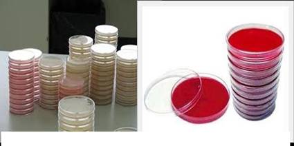 toxoplasma gondii