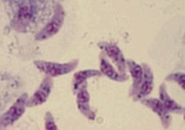 toxoplasma gondii
